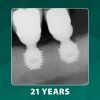 Bicon Short Implant
