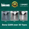 Bicon Short Implant