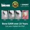 Bicon Short Implant