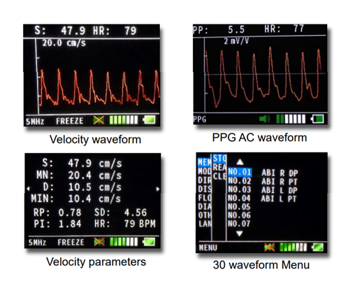 Doppler-Hadeco-Bidop-7