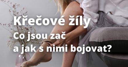 Co jsou křečové žíly a jak s nimi bojovat?