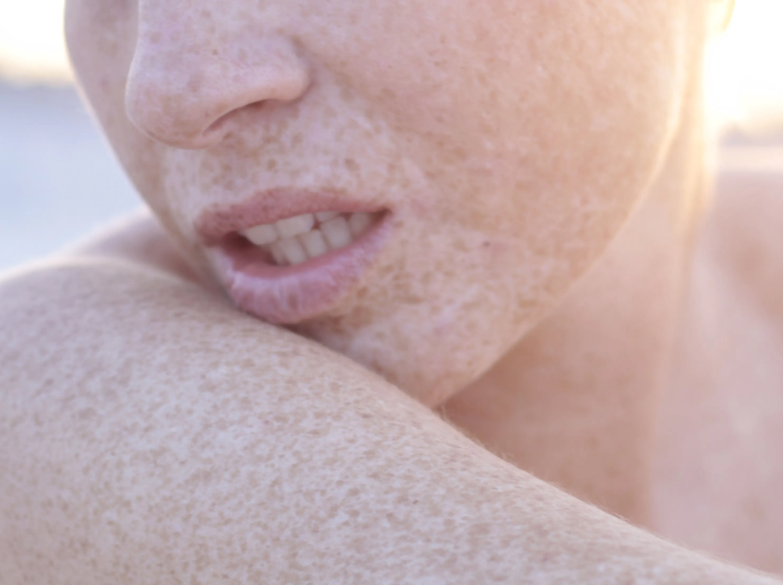 CITLIVÁ NEBO SENZIBILIZOVANÁ POKOŽKA? Jak rozlišit tyto dva stavy pleti?