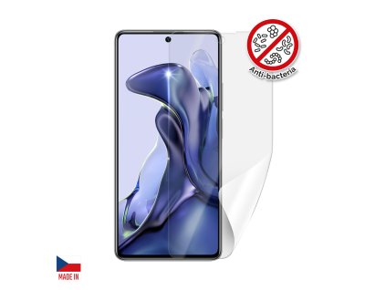 XIA 11TAB D s