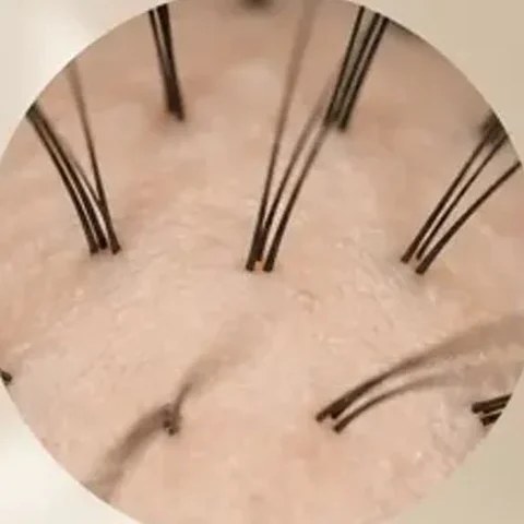Zvětšený detail kořínků vlasů