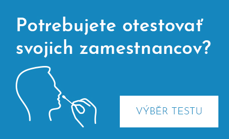 Potrebujete otestovať svojich zamestnancov?