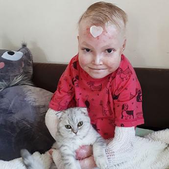 Mají kůži křehkou jako motýlí křídla, ale vlídný dotek jim neublíží