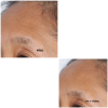 PERRICONE MD (15)