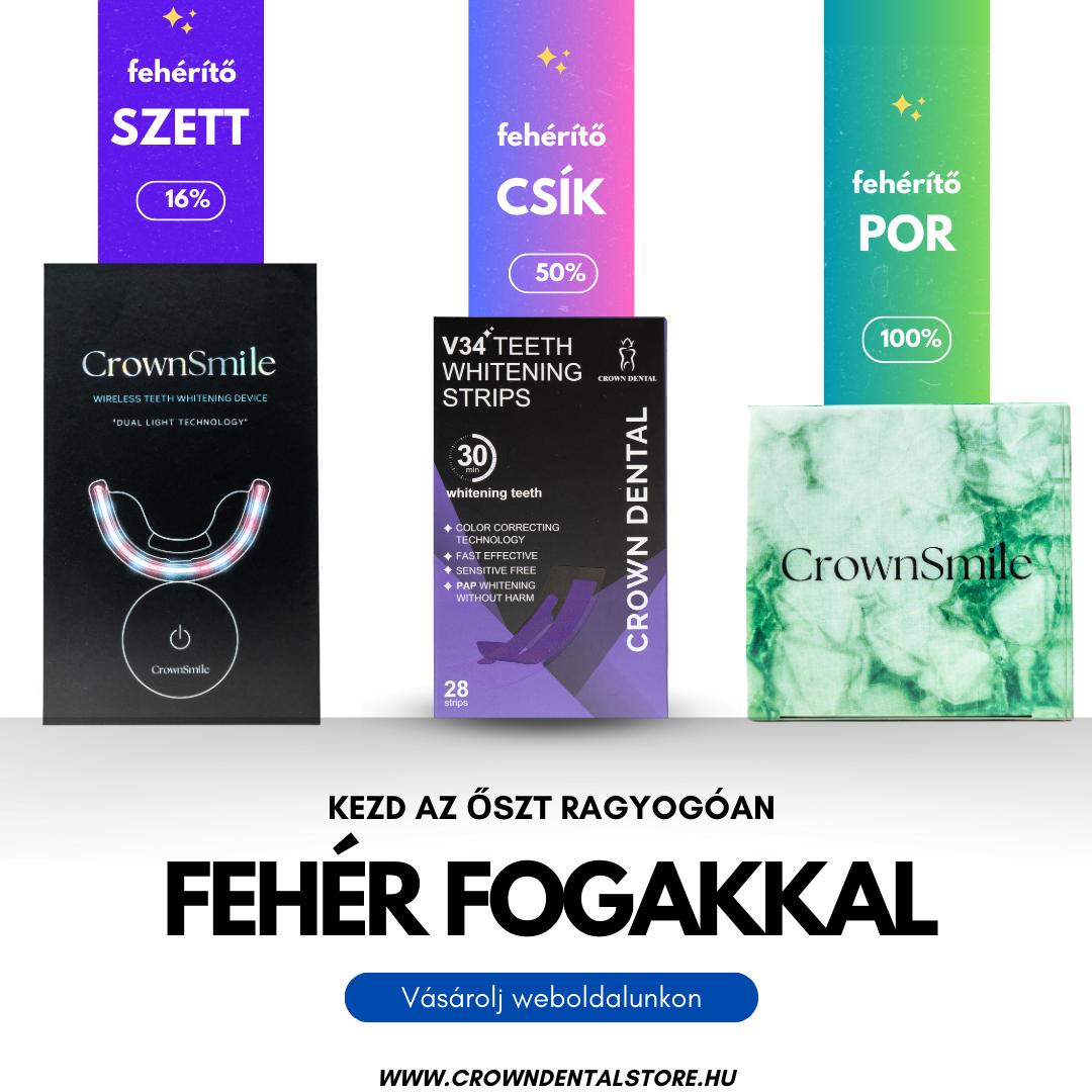 Crown Dental Fogfehérítő Csíkok: Az Otthoni Fogfehérítés Új Szintje