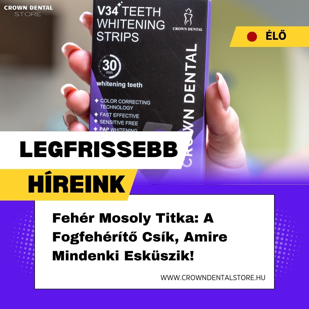 5 érv, amiért neked is ki kell próbálnod a Fogfehérítő Csíkot!