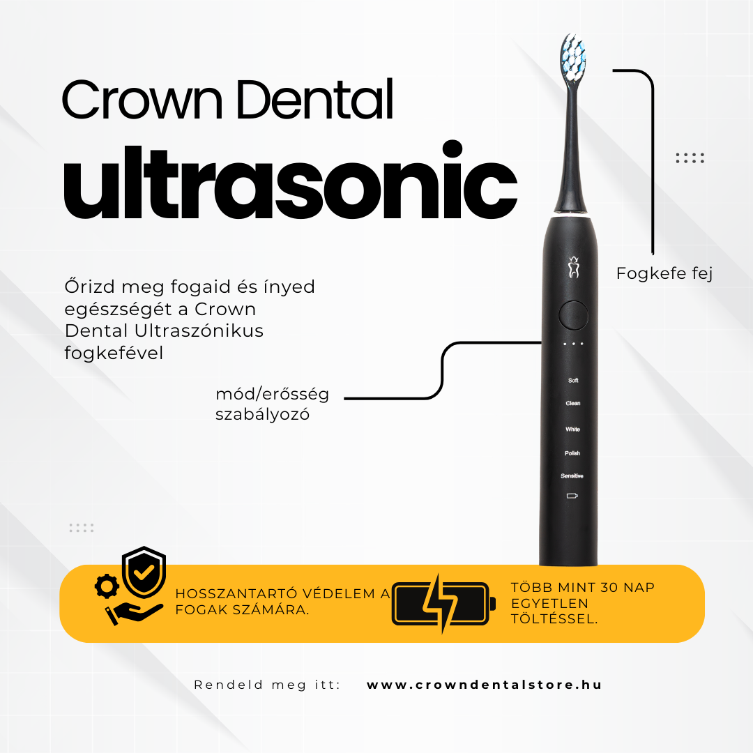 Elektromos fogkefe használata: Gyakori hibák, amiket érdemes elkerülni