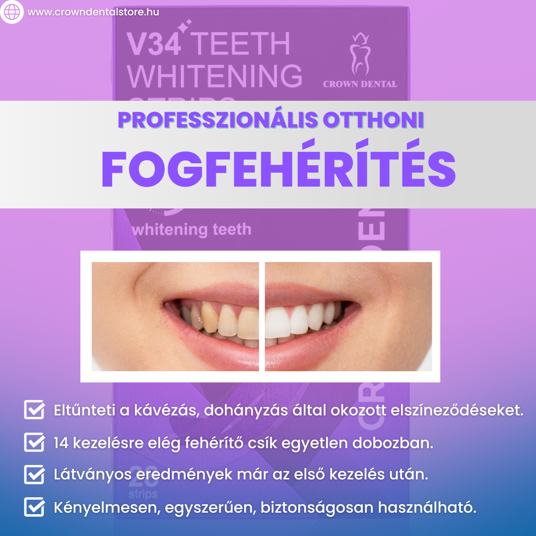 Ragyogó Mosoly Otthon: Ismerd meg a Crown Dental V34 Fogfehérítő Csíkot!