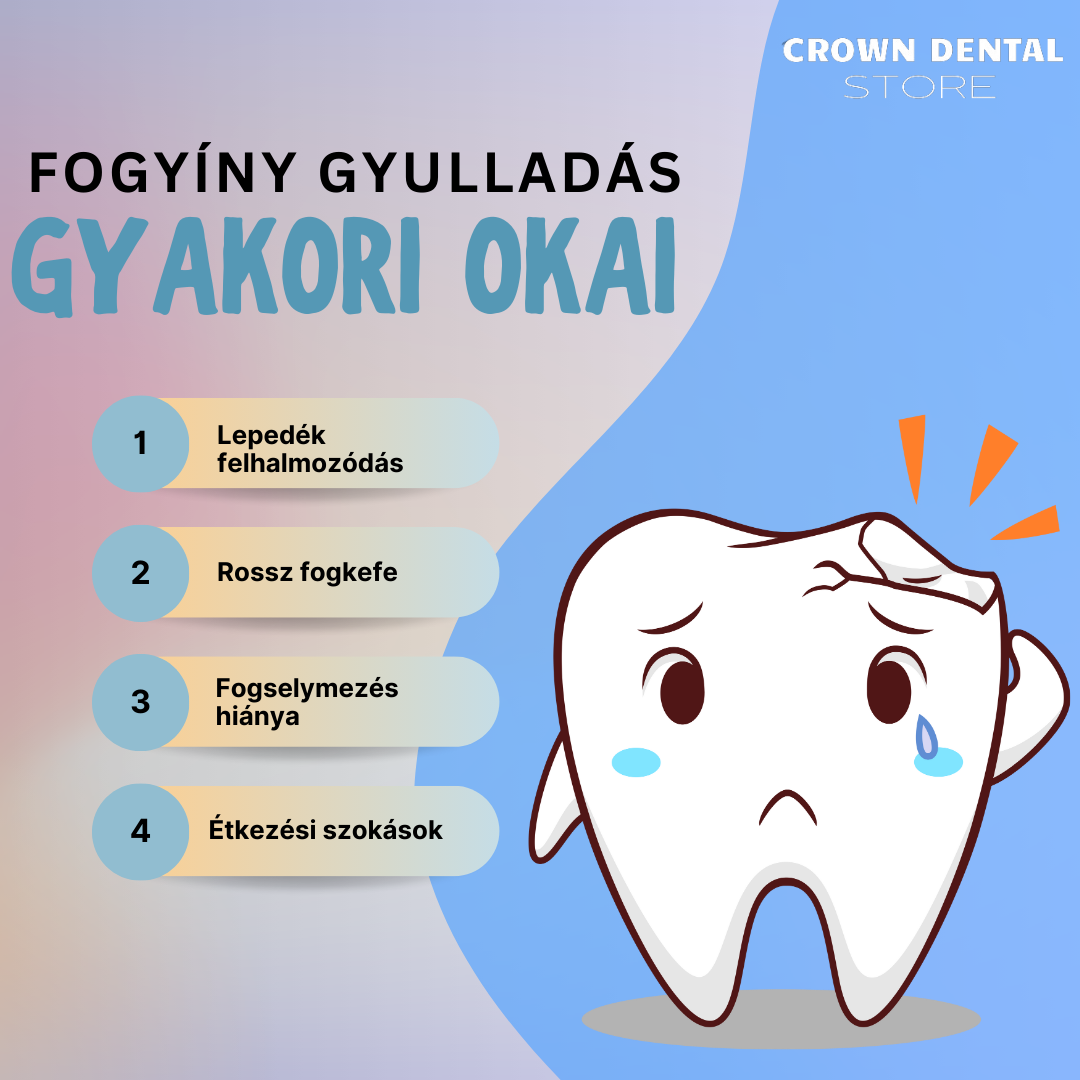 Fogínygyulladás az ünnepek előtt? Ne hagyd, hogy tönkretegye a mosolyod!