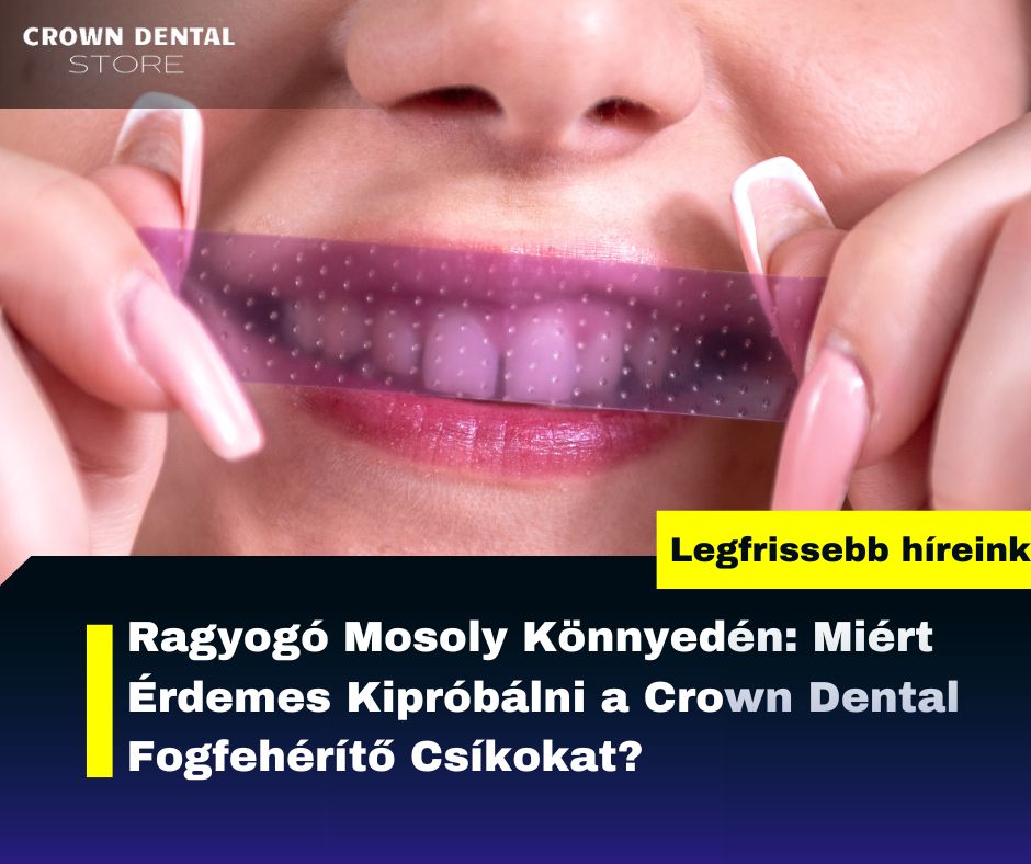 Miért válaszd te is Fogfehérítő Csíkokat?