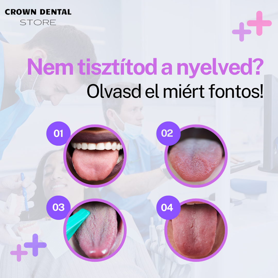 Nyelvtisztítás Elektromos Fogkefével: Hatékony és egyszerű módszer a friss leheletért