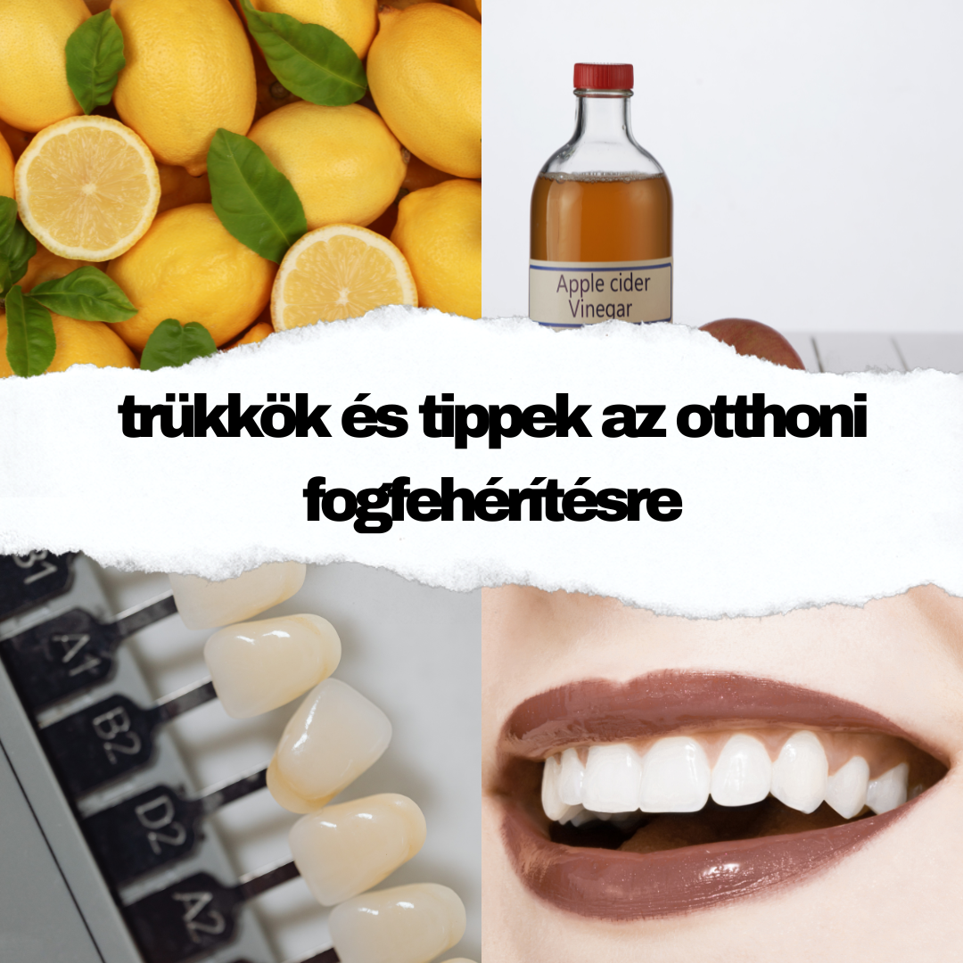 Citrom, Almaecet és Szódabikarbóna Fogfehérítésre: Ártalmas vagy Hatékony?