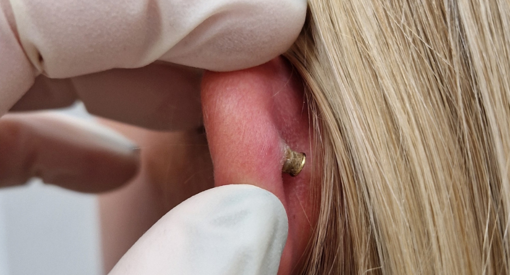 Proč nejsou vhodné velké kamínky a koncovky pro první aplikaci piercingu