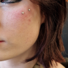 Surface piercing v obličeji