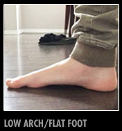 low-arch