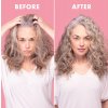 Scalp restore before after