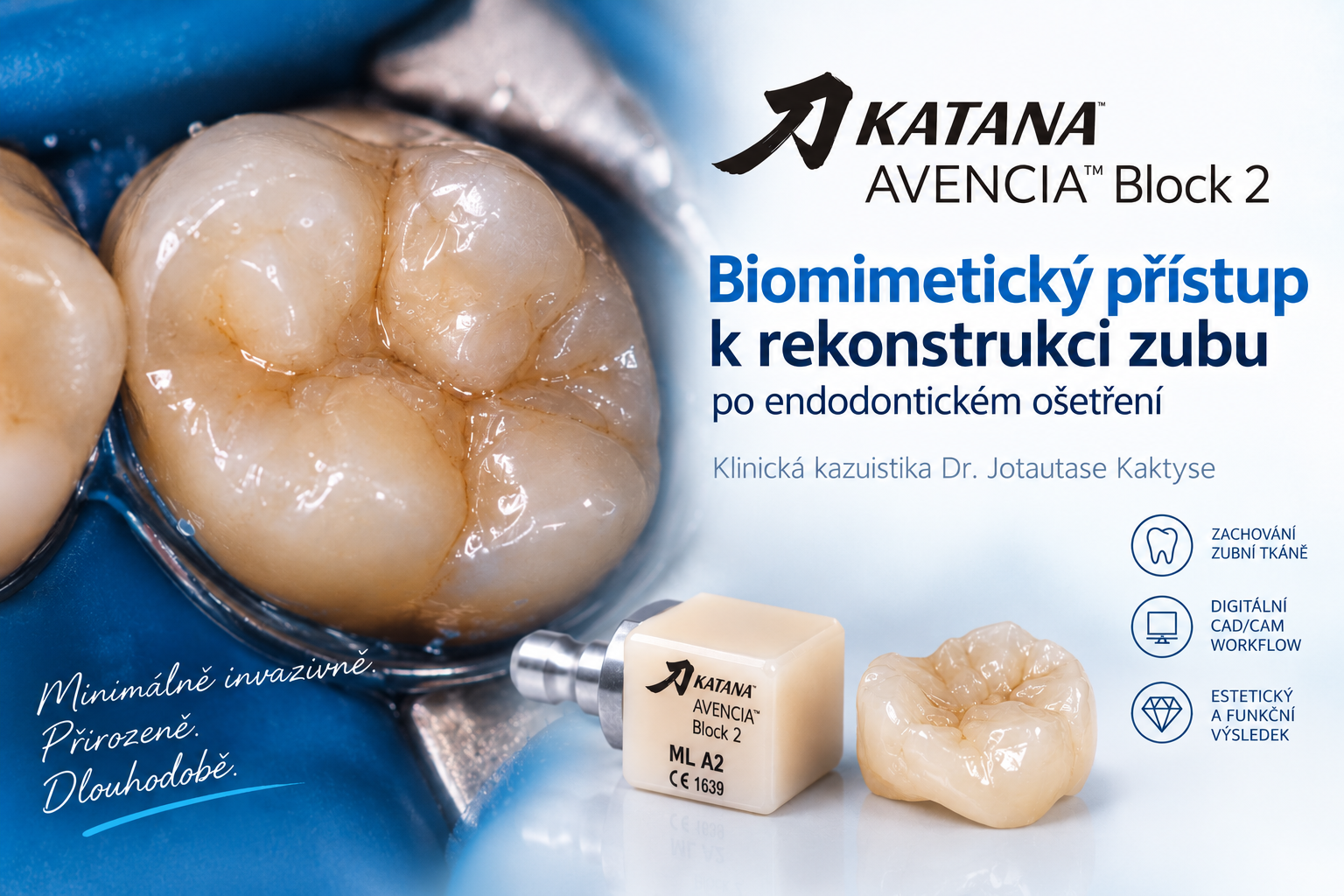 Biomimetický přístup k rekonstrukci zubu po endodontickém ošetření