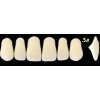 NEW ACE anterior - upper  1x set 6 zubů