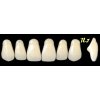 NEW ACE anterior - upper  1x set 6 zubů