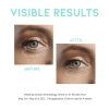 ootd eyeCream3