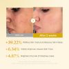 medicube kojic acid toner