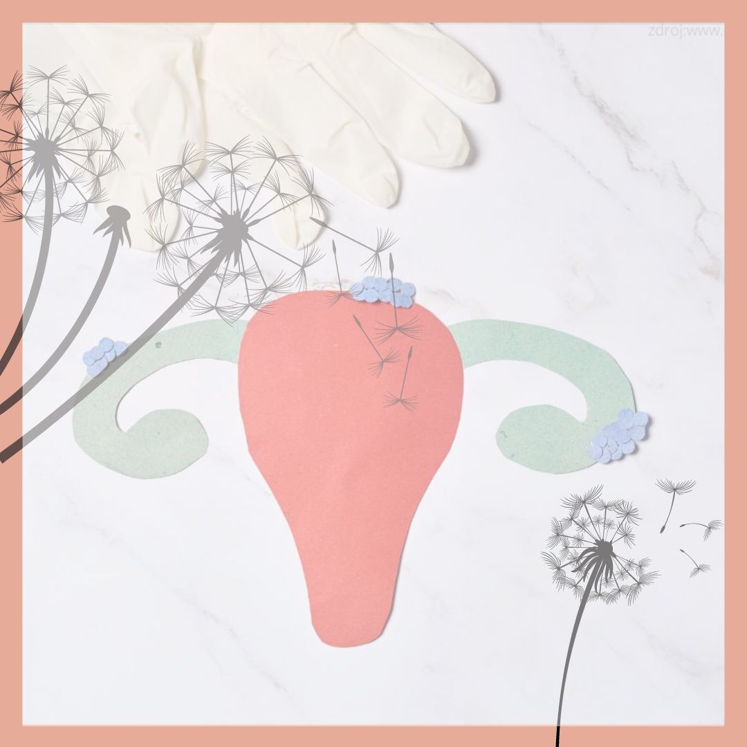 Endometrióza a přírodní léčba