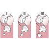 Philips AVENT Dudlík Classic+ variabilní průtok, 2 ks