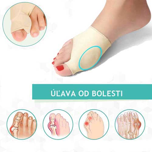 Превръзка на изкълчен палец