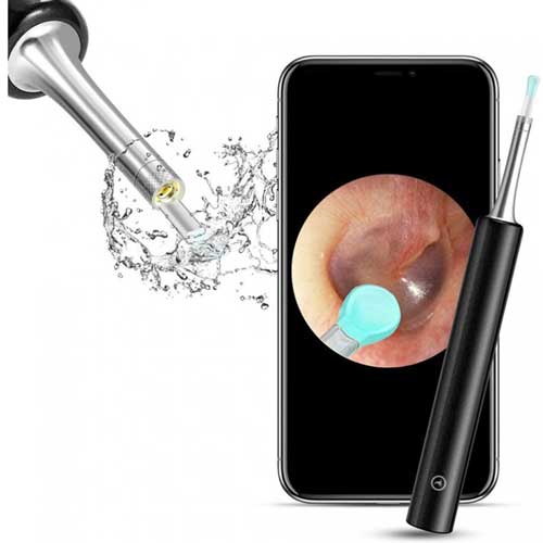 цистични узи