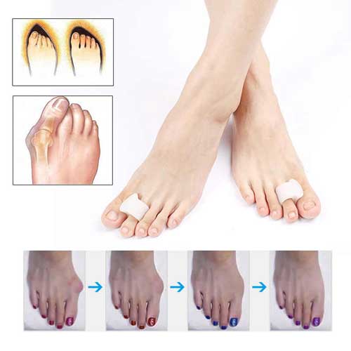 коректор с протектор за палец