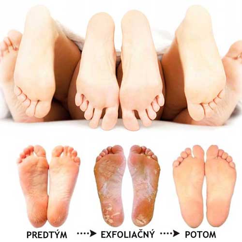 ексфолиращо-пиле-за-крака