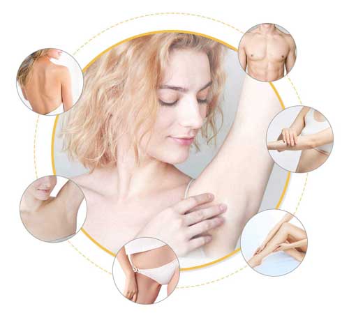 лазерен-епилатор