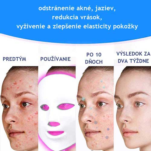 ледена-маска-за-фототерапия