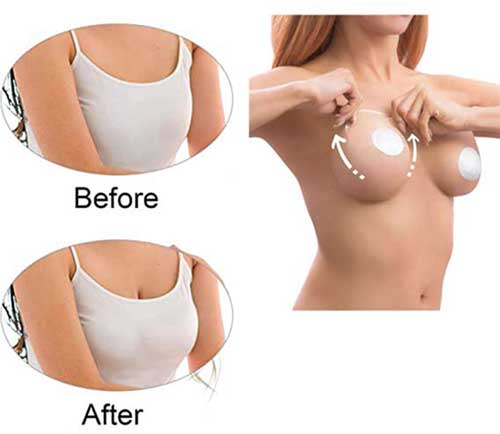 невидимо фолио за повдигане на гърди