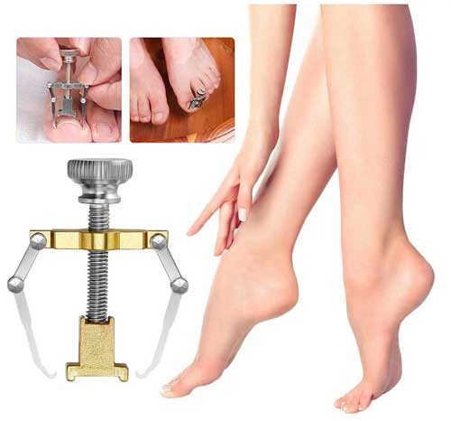 качествен комплект за врастване на нокът