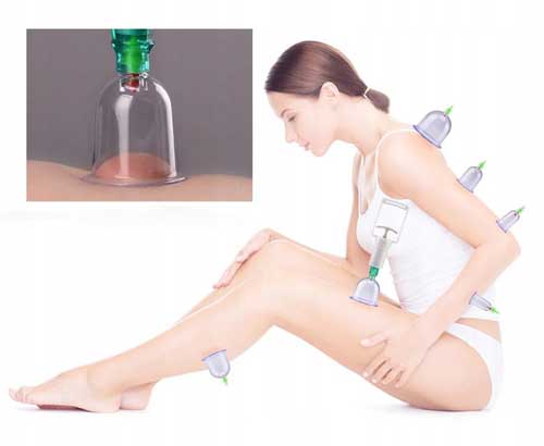 терапевтични-вакуумни-банки