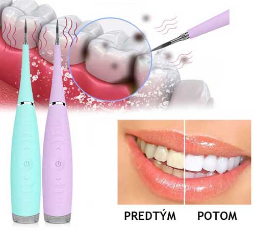 почистващ препарат за зъби