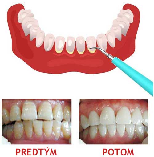 почистващ препарат за зъби