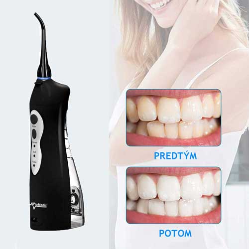 извършено промиване на устата