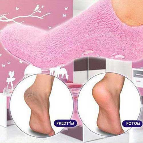 socks-for-foot-problems