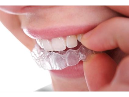 уникална шина против бруксизъм