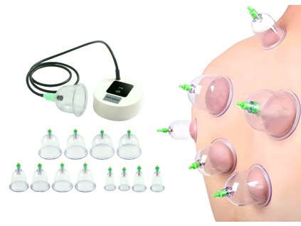 Elektrické čínské masážní vakuové banky sada 3 velikosti