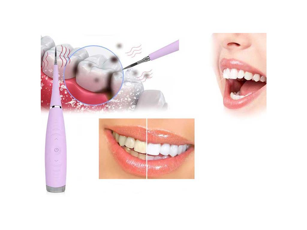 ultrazvučni čistač zuba