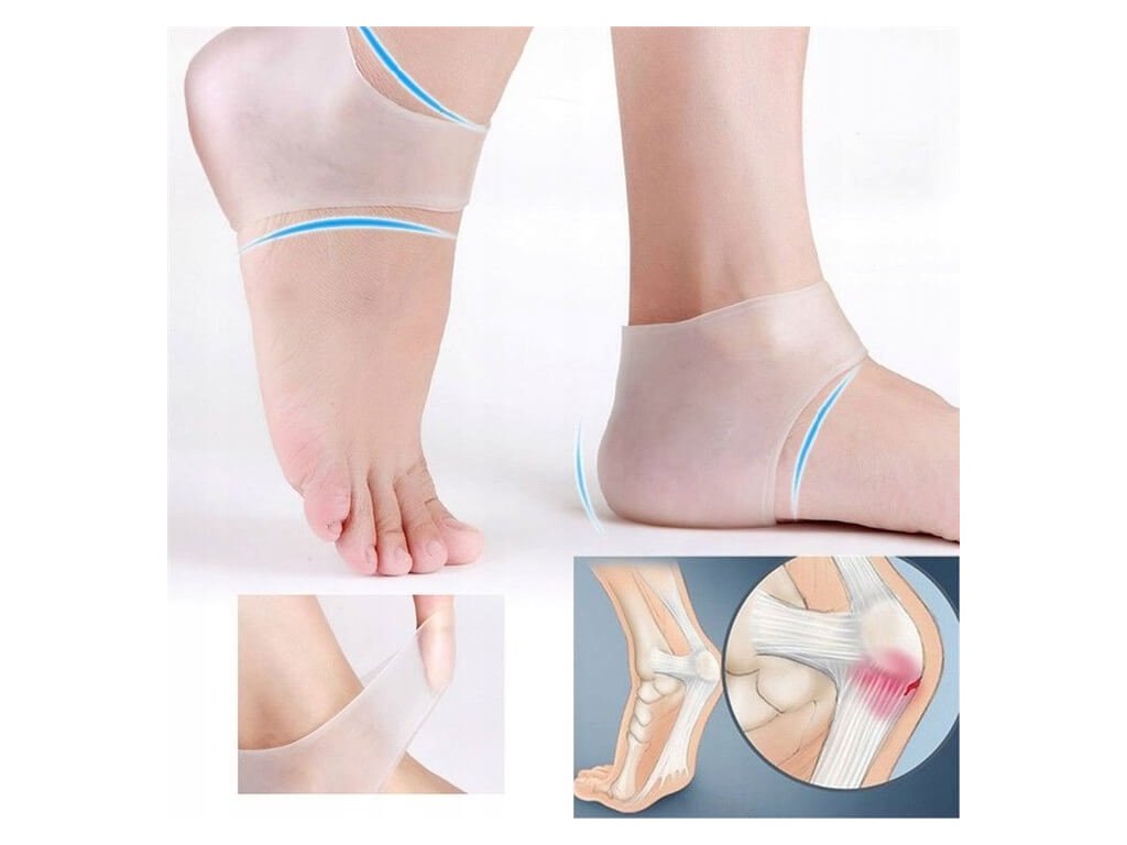 JEDINSTVENI GEL UMETCI ZA CIPELE NA PETU