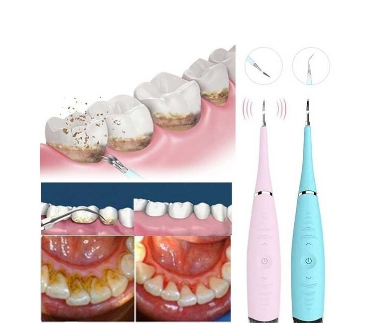 curățare perfectă cu dispozitivul dentar