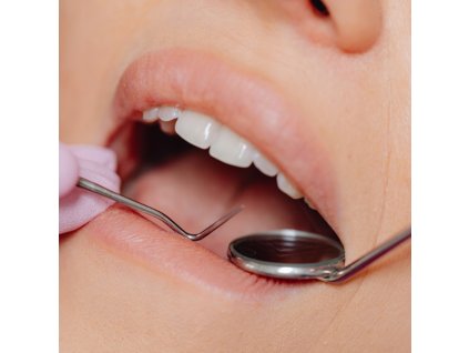 oglindă dentară cu mărire