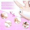 Epilator laser IPL puternic